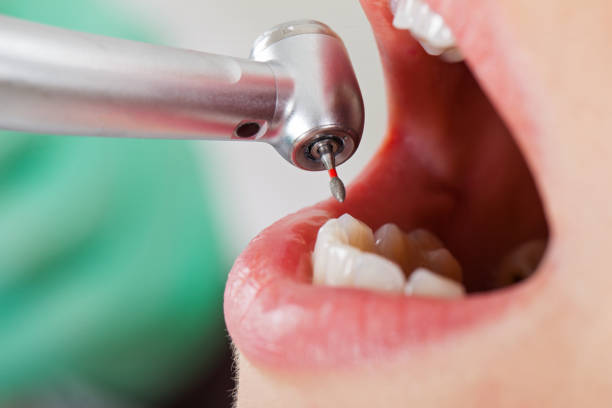 Best Pediatric Emergency Dentist in Lake Wynonah, PA